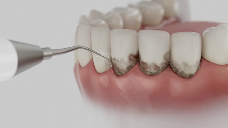 Trusted Dental Implants service in Rio Vista, TX - Dentist Open Now